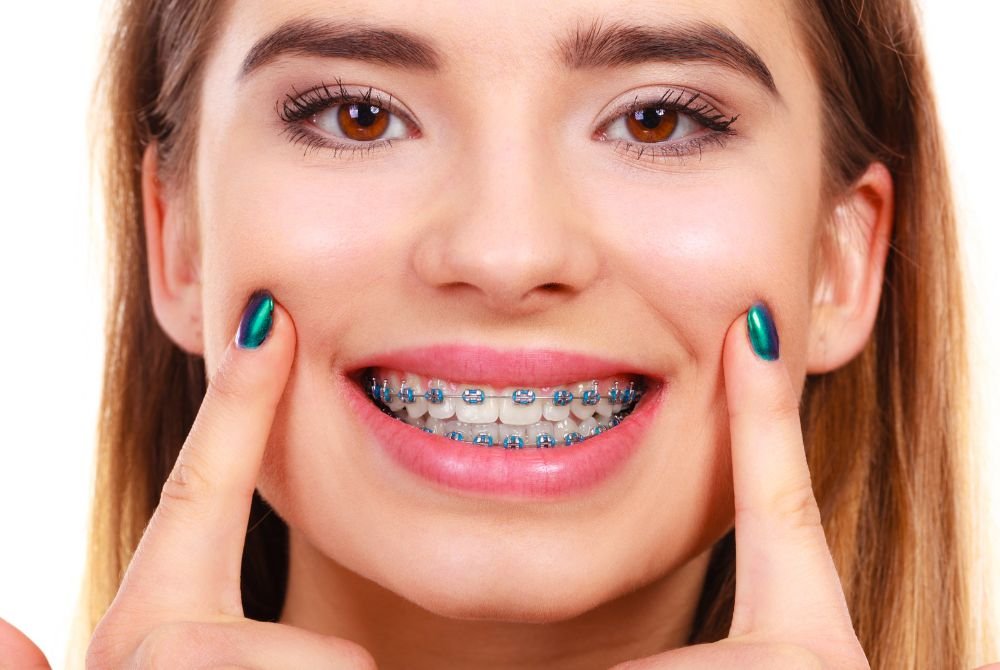 Transform Your Smile: Discover the Types of Braces That Work for You